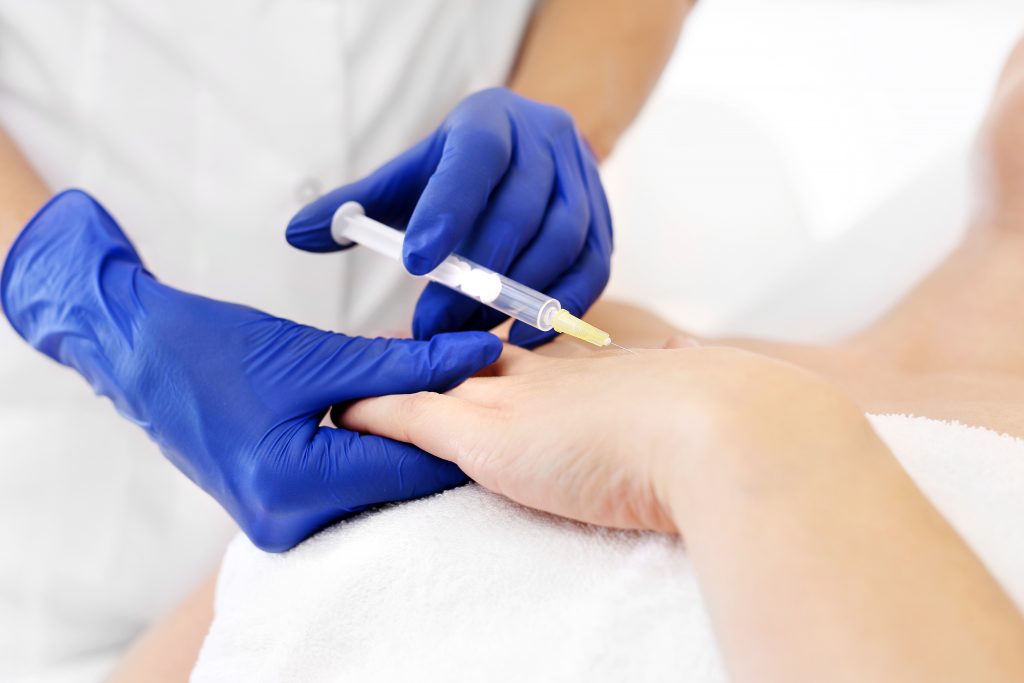 Mezoterapia igłowa dłoni. Kosmetolog wstrzykuje koktajl witaminowy pod skórę dłoni kobiety. Odmładzający zabieg kosmetyczny.