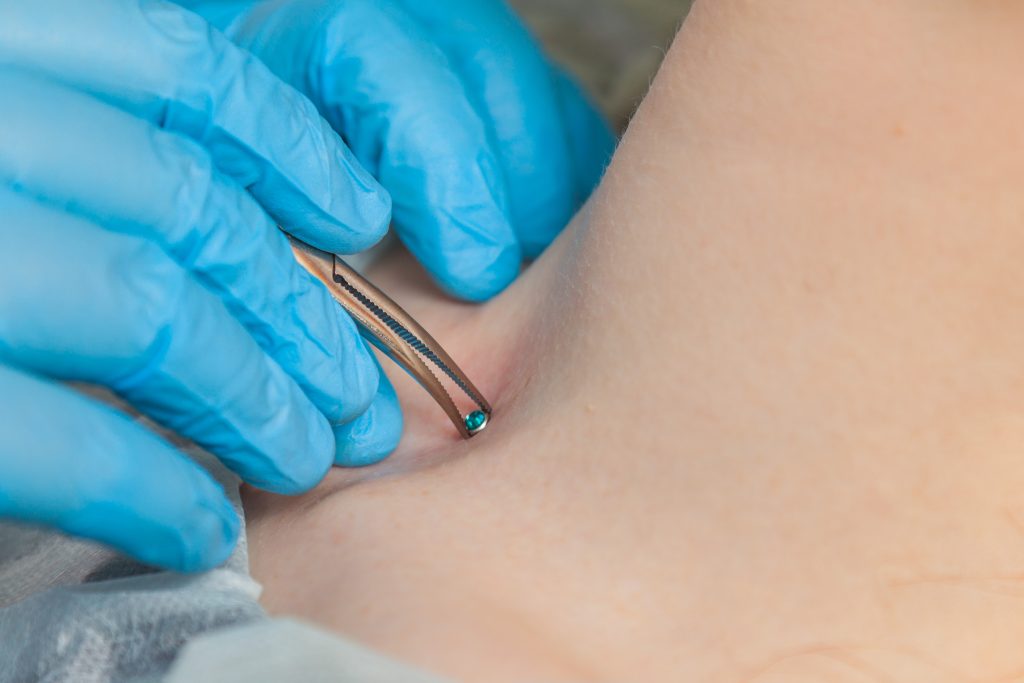 microdermal