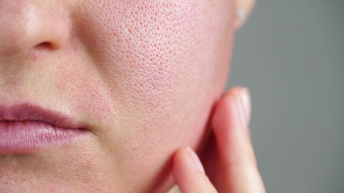 skóra u dermatologa skóra u dermatologa