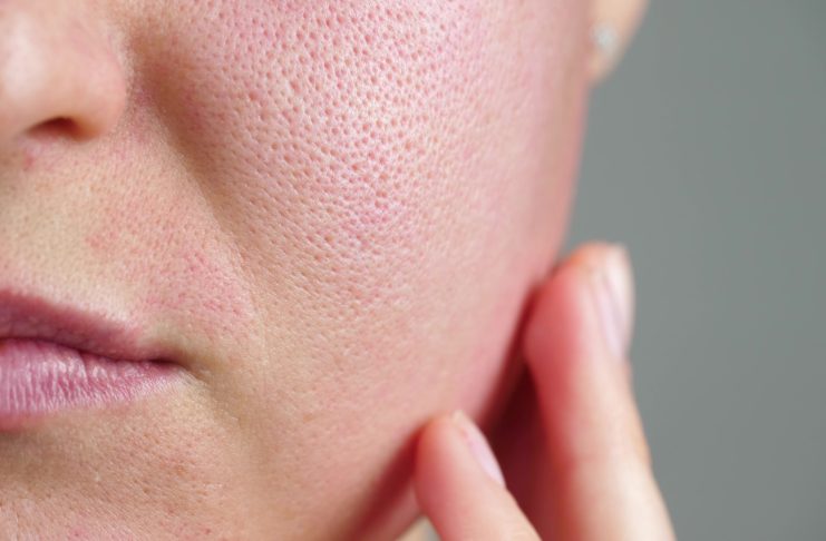 skóra u dermatologa