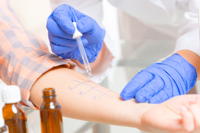 Testy alergiczne w laboratorium Testy alergiczne w laboratorium